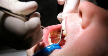 check up oral saúde oral