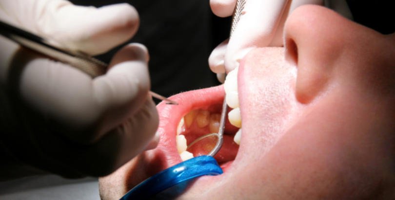 check up oral saúde oral