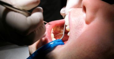 Quase quatro milhões de pessoas com melhores cuidados de saúde oral