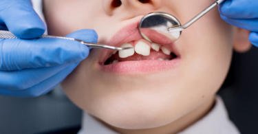 Dentistas querem cheques-dentista a partir dos dois anos de idade