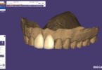 Transferências entre CAD/CAM inLab e DentalCAD mais fáceis com nova parceria