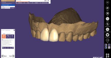 Transferências entre CAD/CAM inLab e DentalCAD mais fáceis com nova parceria