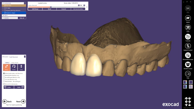 Transferências entre CAD/CAM inLab e DentalCAD mais fáceis com nova parceria