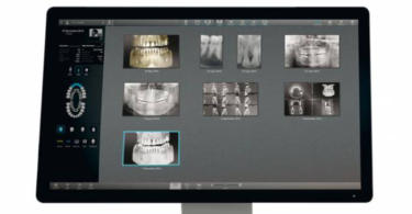 Acteon integra Inteligência Artificial no seu portefólio de Imagiologia