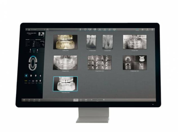 Acteon integra Inteligência Artificial no seu portefólio de Imagiologia