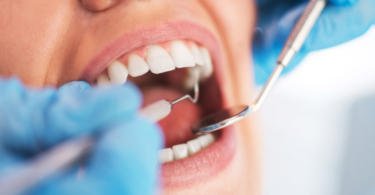 Dentistas podem desempenhar papel crucial na deteção de doenças