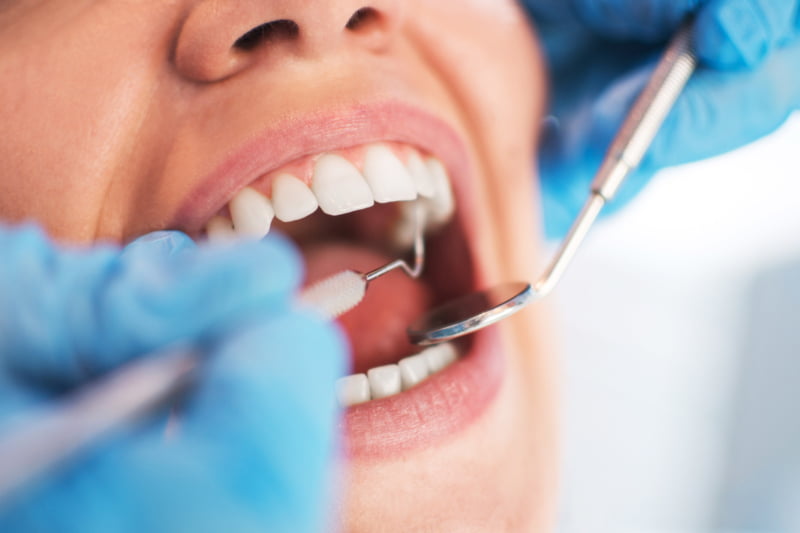 Dentistas podem desempenhar papel crucial na deteção de doenças