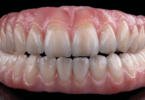 Zirkonzahn lança dois novos modelos de pontes dentárias