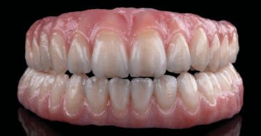 Zirkonzahn lança dois novos modelos de pontes dentárias