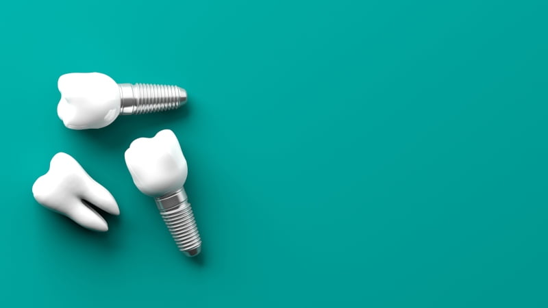 robô realiza primeiro procedimento dentário sem ajuda
