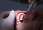 Investigadores desenvolvem nova técnica para regenerar tecido gengival e prevenir perda dentária