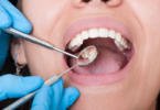 check up oral saúde oral