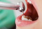 endodontia saúde oral