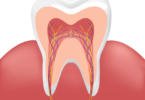 Clínica Smile.up disponibiliza serviço de criopreservação de células estaminais da polpa dentária