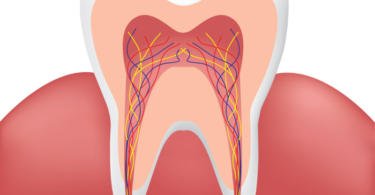 Clínica Smile.up disponibiliza serviço de criopreservação de células estaminais da polpa dentária