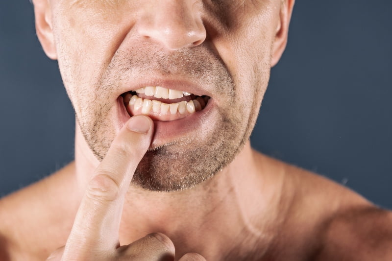 doença periodontal