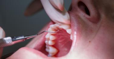 paciente no dentista