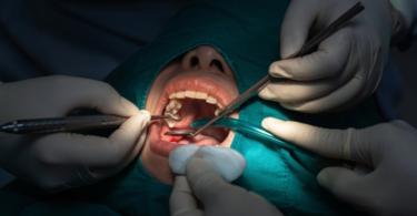 Politécnico de Portalegre cria novo curso na área da medicina dentária