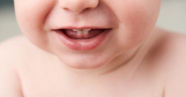 dentes de bebe