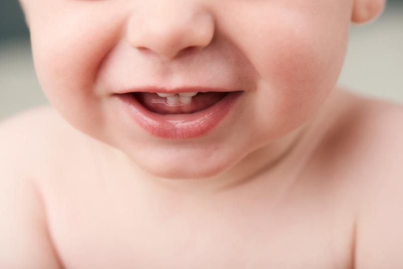 dentes de bebe