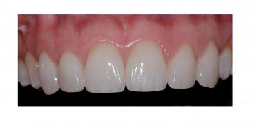 Caso Clínico  Final e