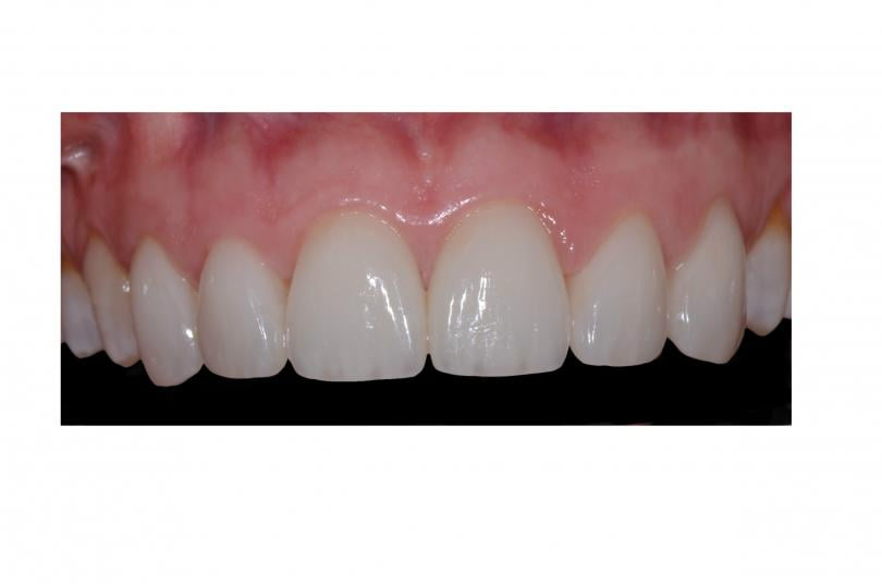 Caso Clínico  Final e