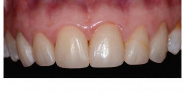 Caso Clínico  Inicial