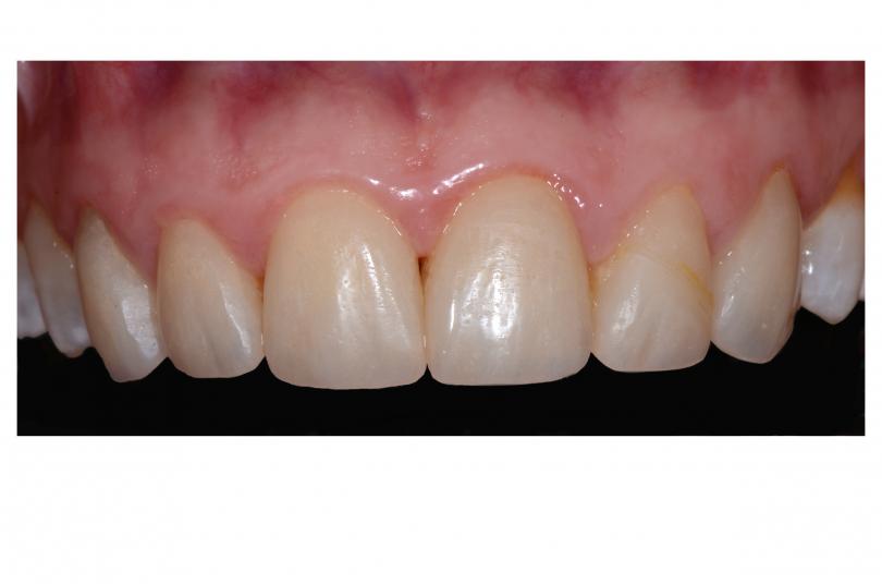 Caso Clínico  Inicial