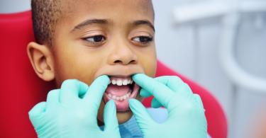 Criaça no Dentista