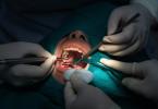 Curso de Dentisteria Minimamente Invasiva da FMUC já tem data
