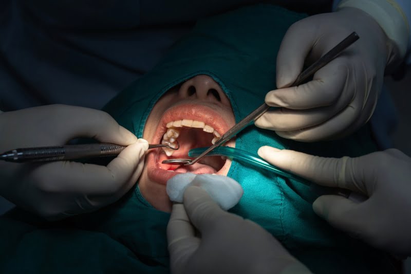 Curso de Dentisteria Minimamente Invasiva da FMUC já tem data