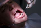 Periodontite pode mesmo aumentar o risco de doenças cardiovasculares