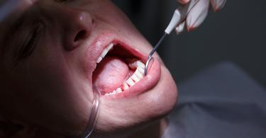 Periodontite pode mesmo aumentar o risco de doenças cardiovasculares