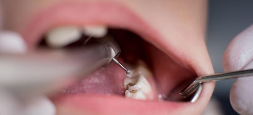 saude oral