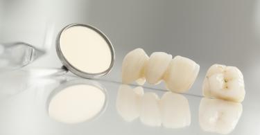 Especialista discute restaurações modernas de cerâmica em webinar gratuito