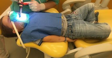 Colocação de uma coroa de zircónia pré formada num molar temporário de um paciente não colaborador