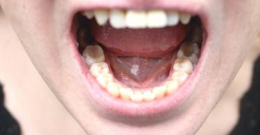 Mais de cinco mil biópsias realizadas no âmbito do PIPCO