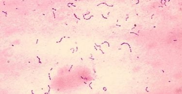 Terapia fotodinâmica de luz dupla ajuda a matar bactérias orais