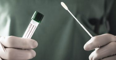 CDS propõe reforço de centro de testes de Covid-19 com veterinários e dentistas