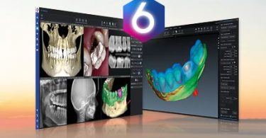 Lançada nova versão de ‘software all-in-one’ da Planmeca