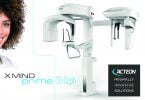 Acteon lança X-mind prime 3d ceph