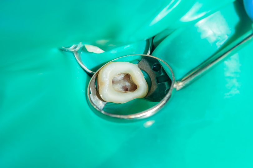 Investigadores brasileiros criam composto natural para tratamento dos dentes