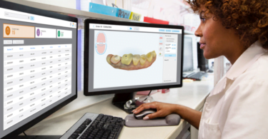 Tecnologia Align lança workflow do laboratório MyiTero