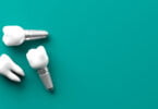 Investigadores implantes dentários