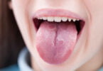 cavidade oral