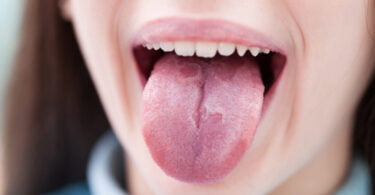 cavidade oral