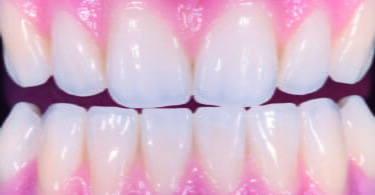 Zirkonzahn lança novo Prettau Dispersive