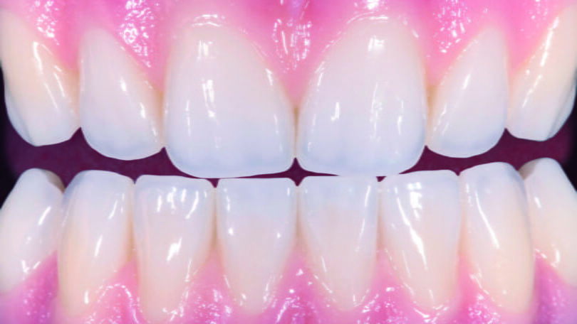 Zirkonzahn lança novo Prettau Dispersive