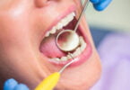 Lembre três complicações que podem começar na saúde oral 