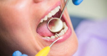 Lembre três complicações que podem começar na saúde oral 